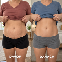 Lade das Bild in den Galerie-Viewer, Formkur - Anti-Cellulite Massagegerät für Bauch, Beine & Po