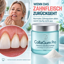 Lade das Bild in den Galerie-Viewer, CollaGum Pro – Kollagen-Zahnfleischpflege für Reparatur, Aufbau &amp; Regeneration
