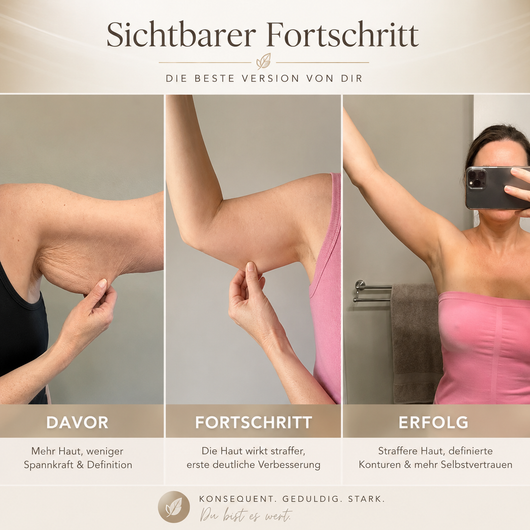 LumaLift Pro - Gerät zur Formung und Straffung von Armen & Körper