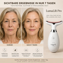 Lade das Bild in den Galerie-Viewer, LumaLift Pro - Gerät zur Formung und Straffung von Armen &amp; Körper