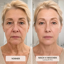 Lade das Bild in den Galerie-Viewer, LumaLift Pro - Gerät zur Formung und Straffung von Armen &amp; Körper