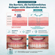 Lade das Bild in den Galerie-Viewer, CollaGum Pro – Kollagen-Zahnfleischpflege für Reparatur, Aufbau &amp; Regeneration
