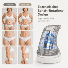 Lade das Bild in den Galerie-Viewer, Formkur - Anti-Cellulite Massagegerät für Bauch, Beine &amp; Po