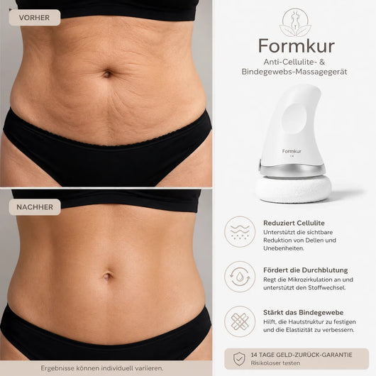 Formkur - Anti-Cellulite Massagegerät für Bauch, Beine & Po