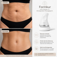 Lade das Bild in den Galerie-Viewer, Formkur - Anti-Cellulite Massagegerät für Bauch, Beine &amp; Po